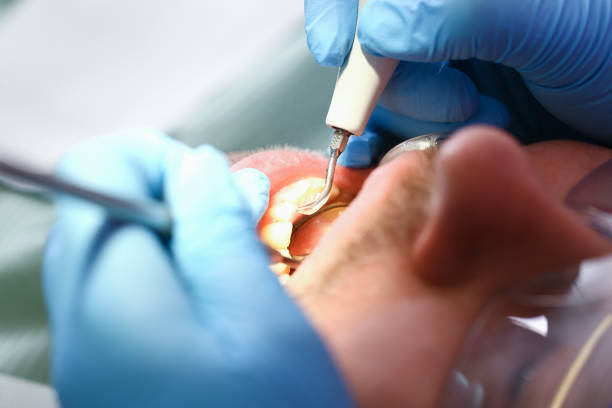 Best Tooth Pain Emergency Relief  in Steubenville, OH