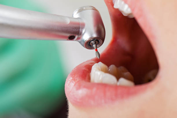 Best Dentist for Dental Trauma  in Steubenville, OH